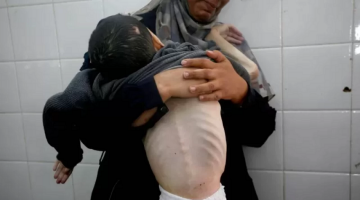 Gazze’de açlık krizi: Ölü sayısı 339’a yükseldi