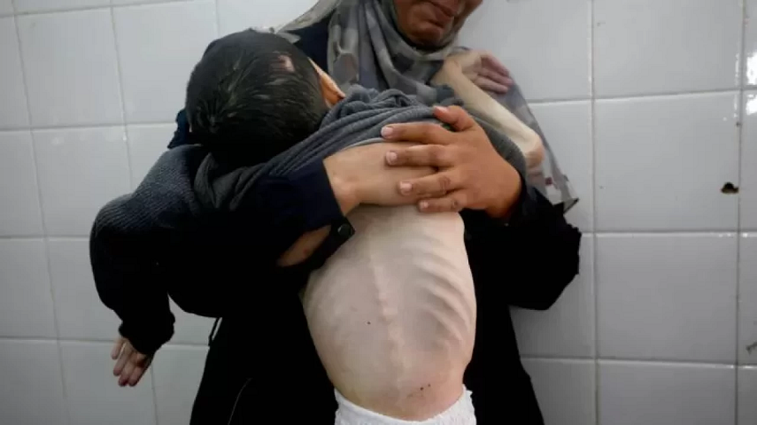 Gazze’de açlık krizi: Ölü sayısı 339’a yükseldi