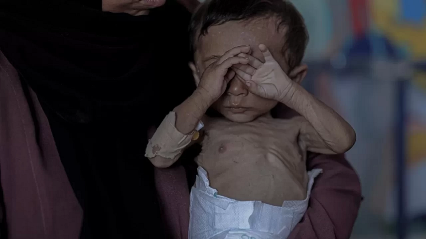 İsrail’in kıtlığı dayattığı Gazze’de açlıktan ölenlerin sayısı 263’e yükseldi
